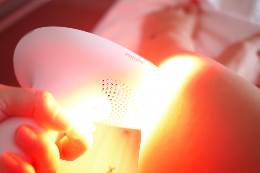 Lumea Philips Advanced Doudou Stiletto lumea-philips-advanced-doudou-stiletto